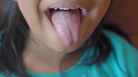 primer plano de la lengua de una niña con una capa blanca - posible trucha oral