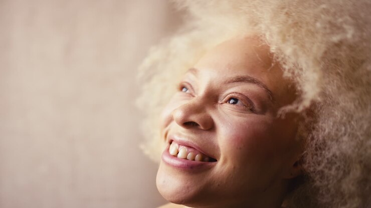 Ritratto in studio di una donna albina naturale e sicura in biancheria intima che promuove la positività del corpo