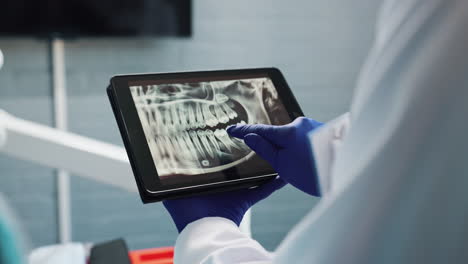 dentist analyzing dental x-ray on a tablet