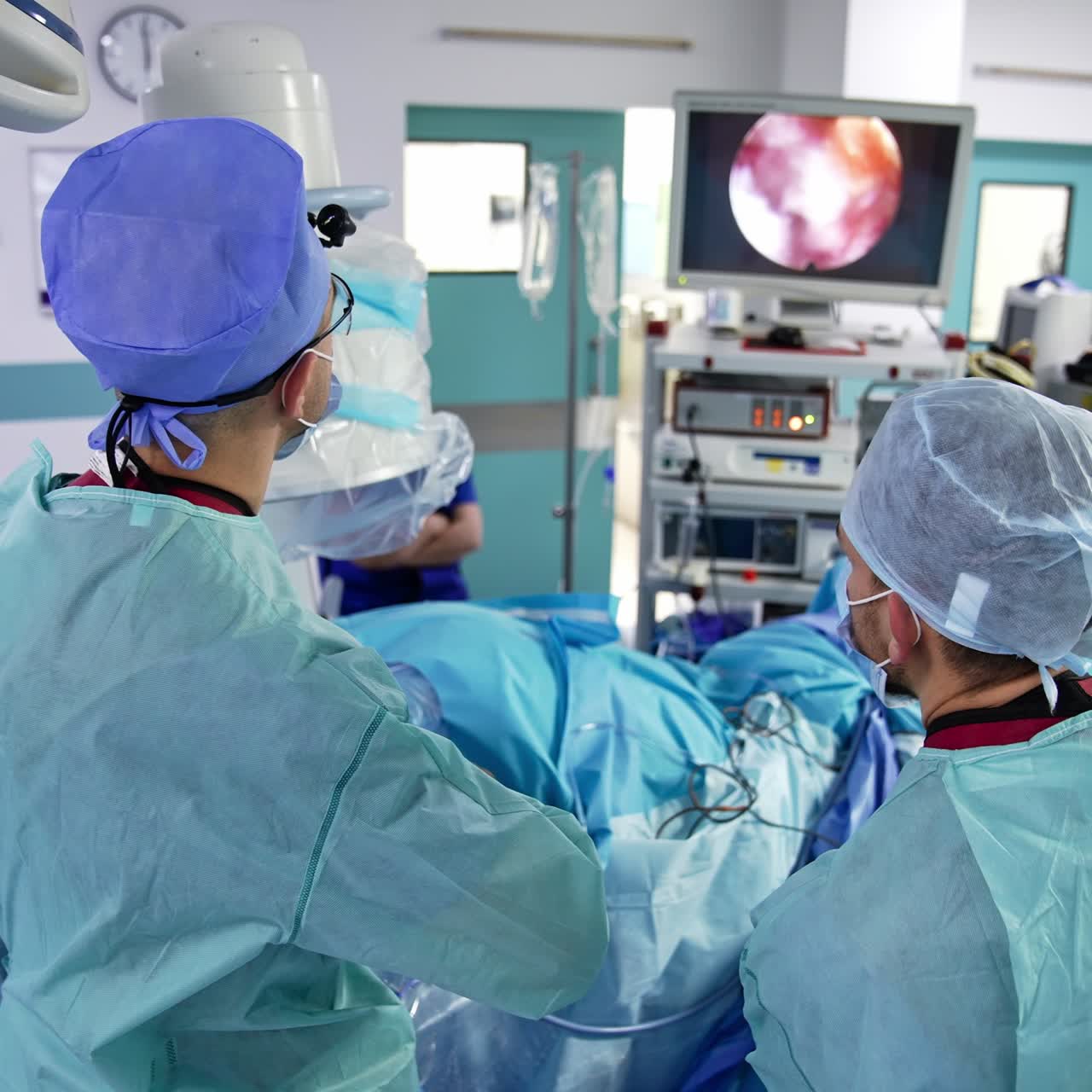 Neurosurgeon looks at the screen during operation and applies metal tool. Doctors stand over the patient with their backs to the camera watching the monitor