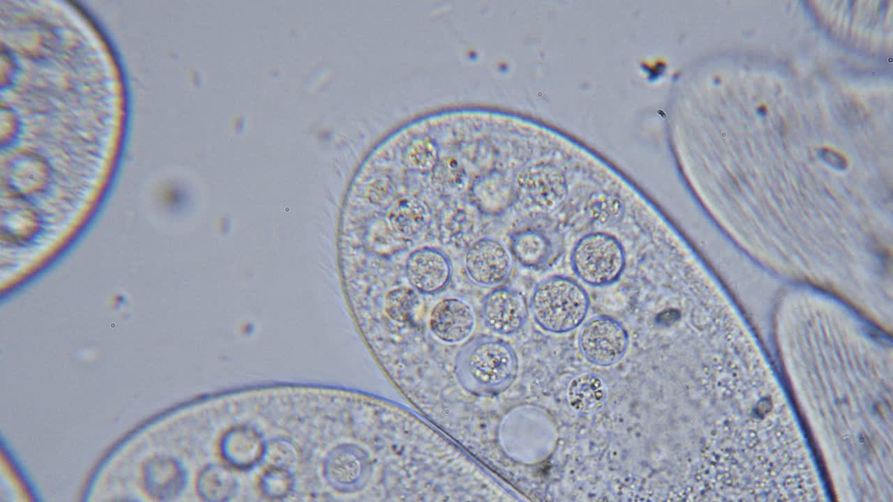 alta densidad de protozoos paramecium unicelulares bajo el microscopio