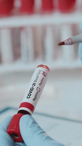 healthcare professional conducts blood test for covid21 in clinical setting