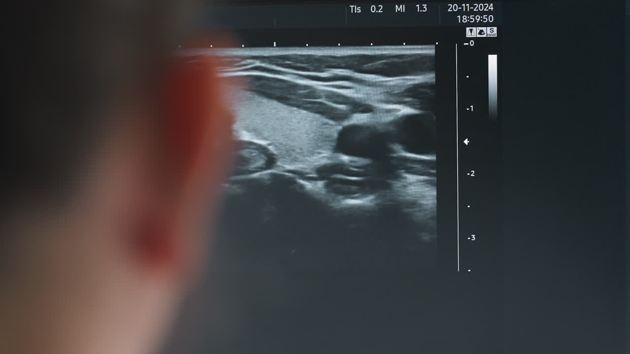 Ultrasound monitor showing detailed movement of internal organs during patient examination with close up on screen visuals and subtle reflection of observer in foreground for clinical insight