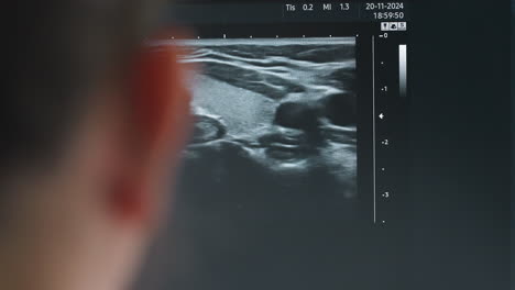 ultrasound monitor showing detailed movement of internal organs during patient examination with close up on screen visuals and subtle reflection of observer in foreground for clinical insight