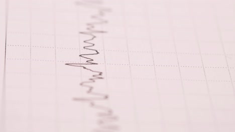 ecg/electrocardiogram graph