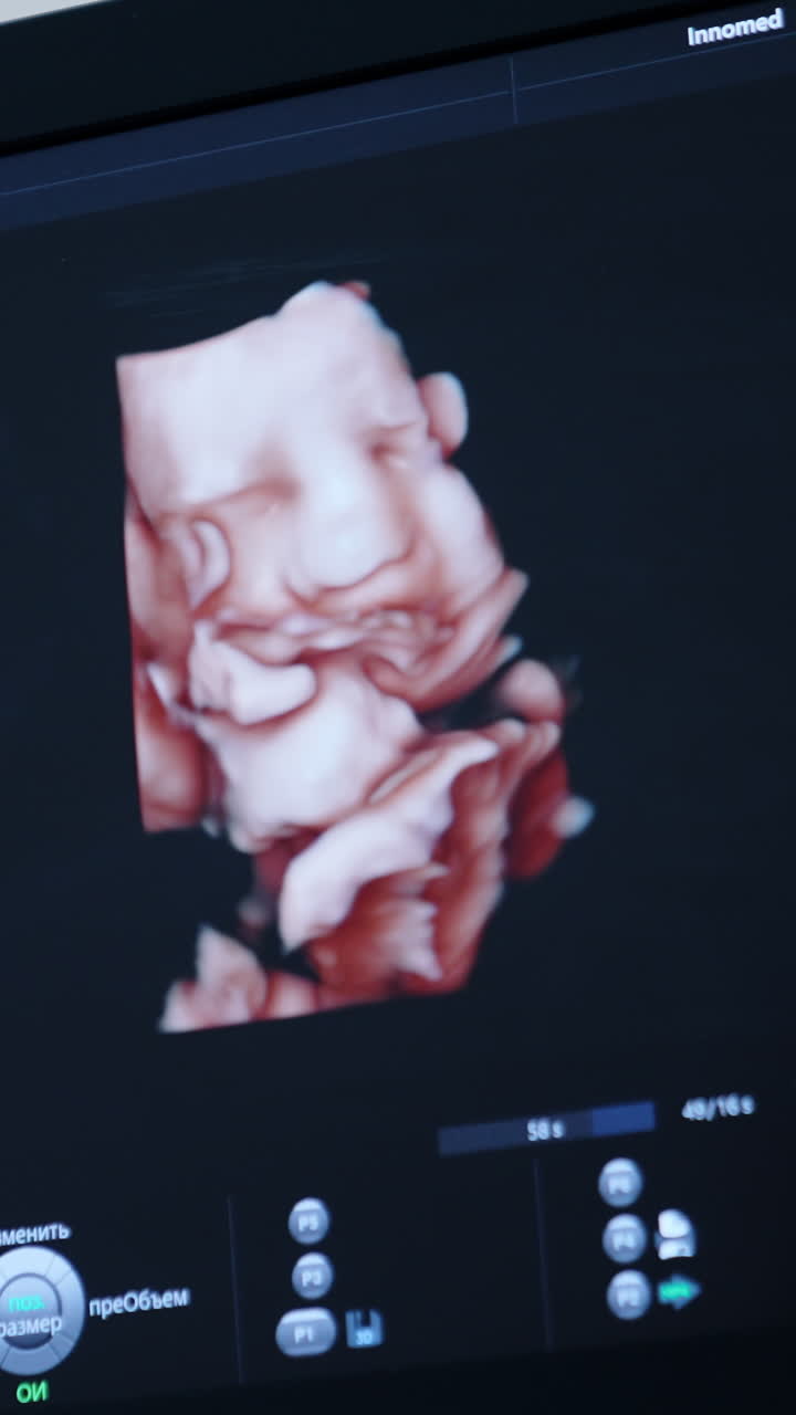 3d fetal image on the screen of ultrasound machine. Checking the development of a baby. Vertical video