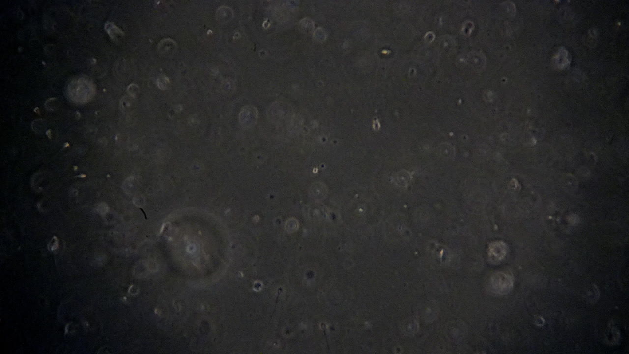 células espermáticas microscópicas que nadan en el semen