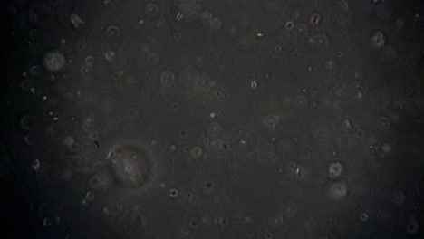 microscopic sperm cells swimming in semen