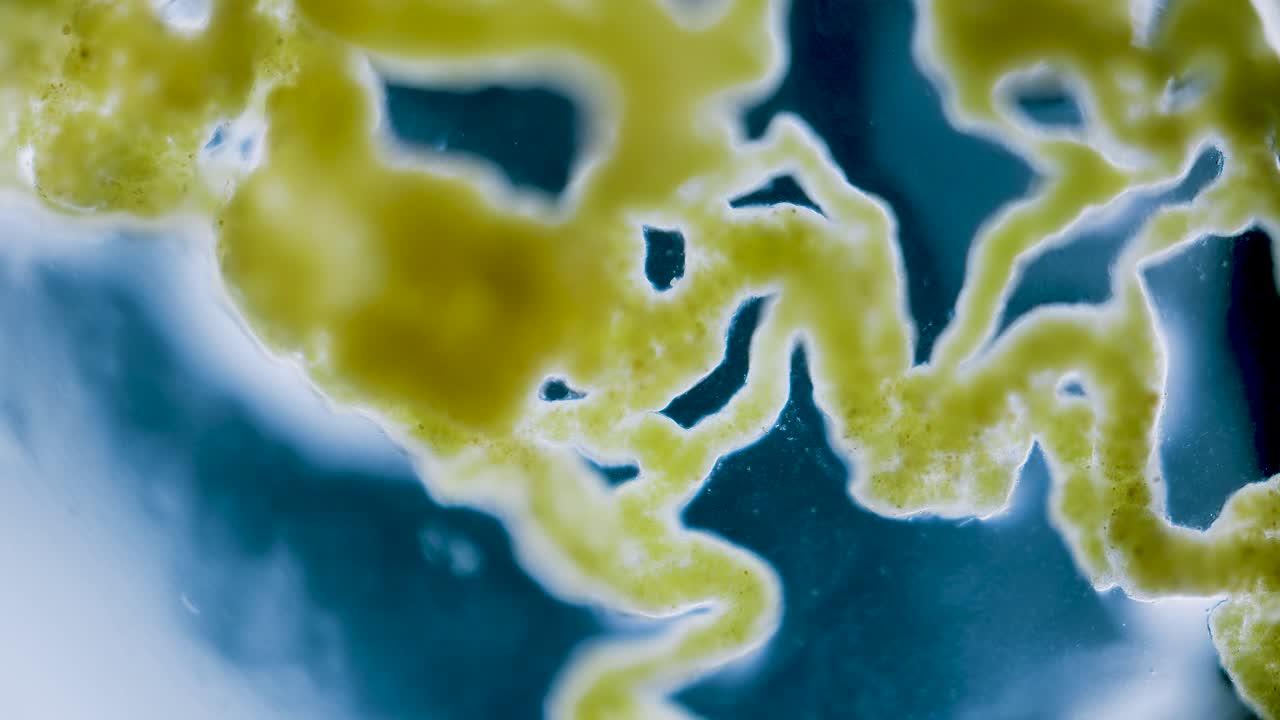 Slime mold plasmodium under microscope