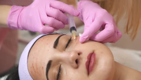 tratamiento por inyección facial