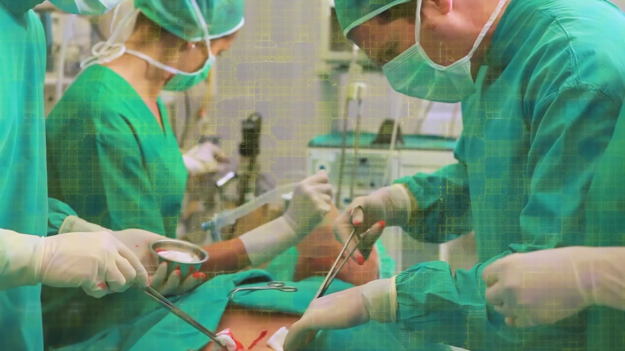 Animation of yellow grid processing data over diverse group of surgeons operating on patient