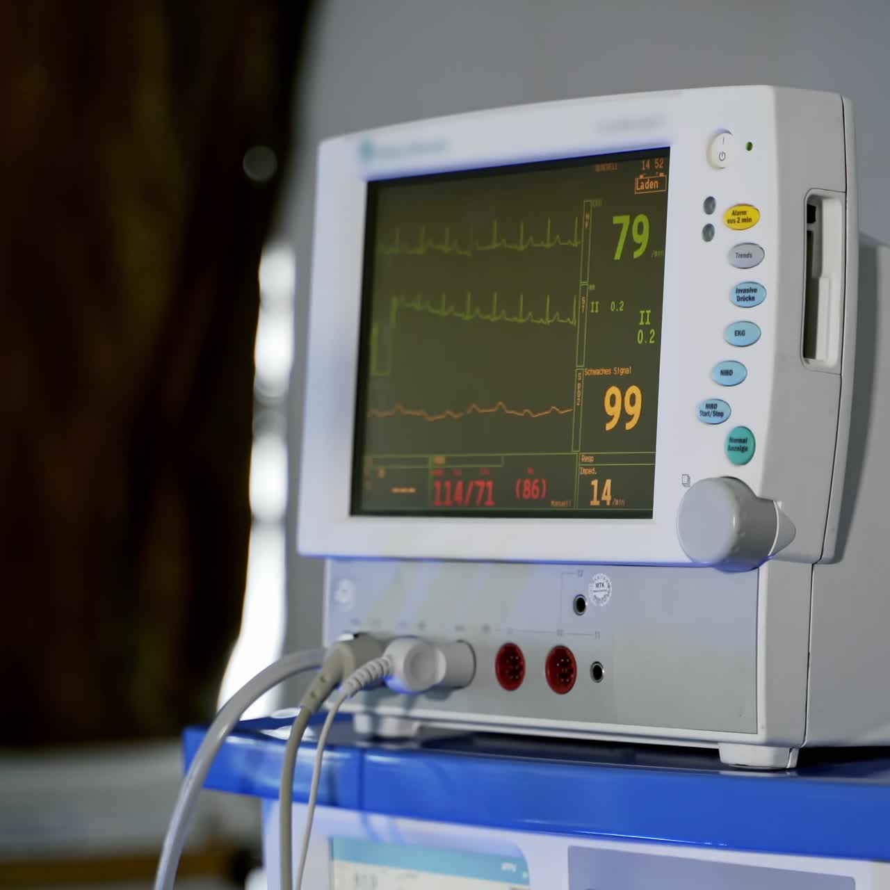 Heart rate monitor in hospital theater. Medical vital signs monitor instrument in a hospital on anesthesia surgery monitor. Patient's heartbeat at the screen.