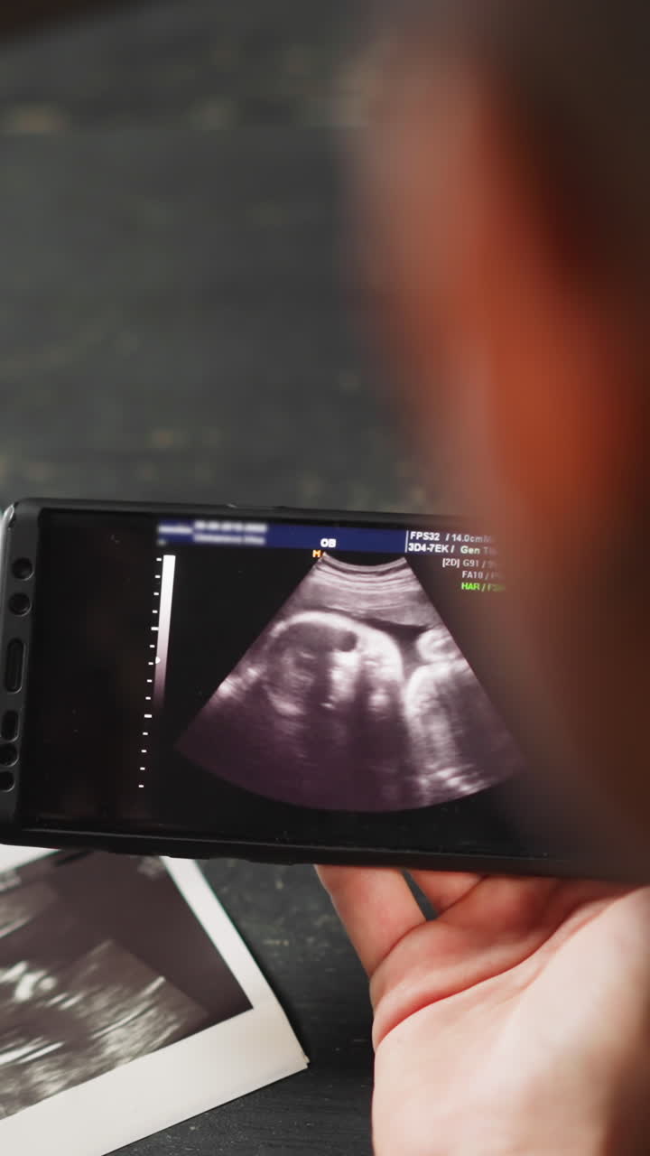 Happy future parents white woman and black husband enjoy baby moves ultrasound record via smartphone in living room extreme closeup slow motion