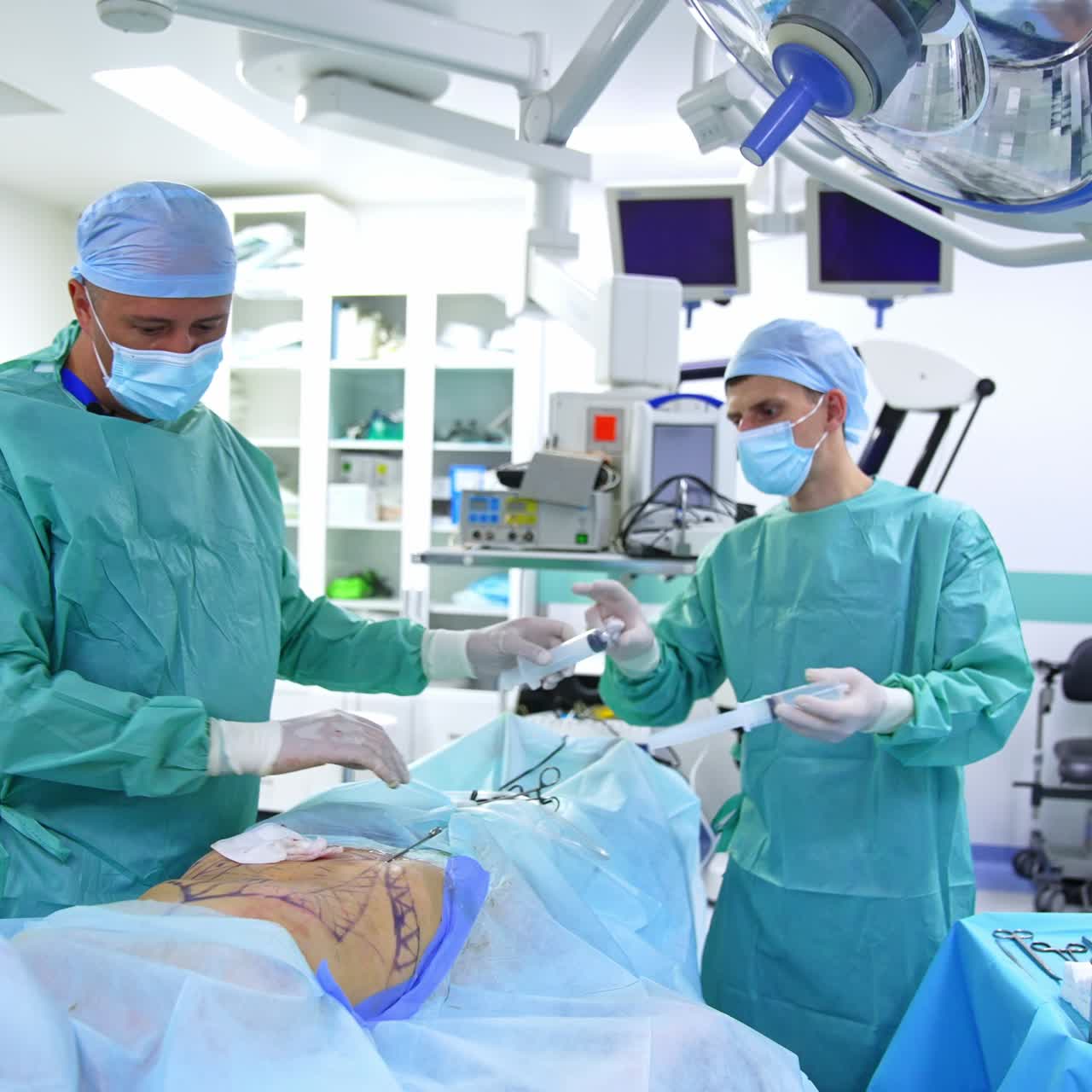 Single male doctor performing liposuction surgery in modern backdrop. Assistant passing the new syringe to the surgeon