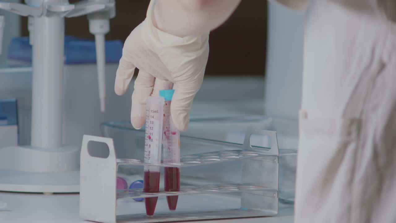 Laboratory scientist grabbing test tubes with blood from holder and marking it, closeup view