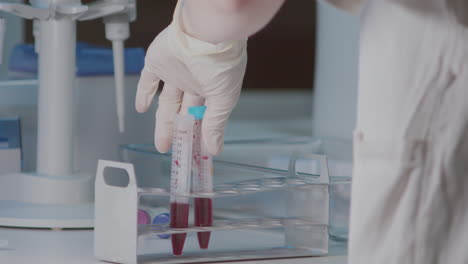 laboratory scientist grabbing test tubes with blood from holder and marking it, closeup view