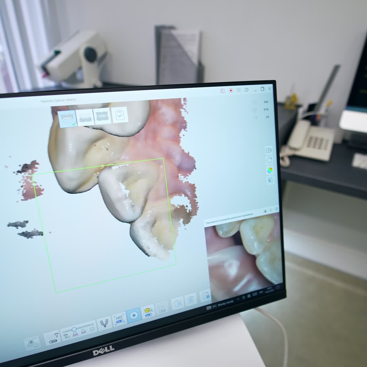 Looking at 3d denture projection on the screen of advanced equipment. Picture on the monitor moving and rotating close up
