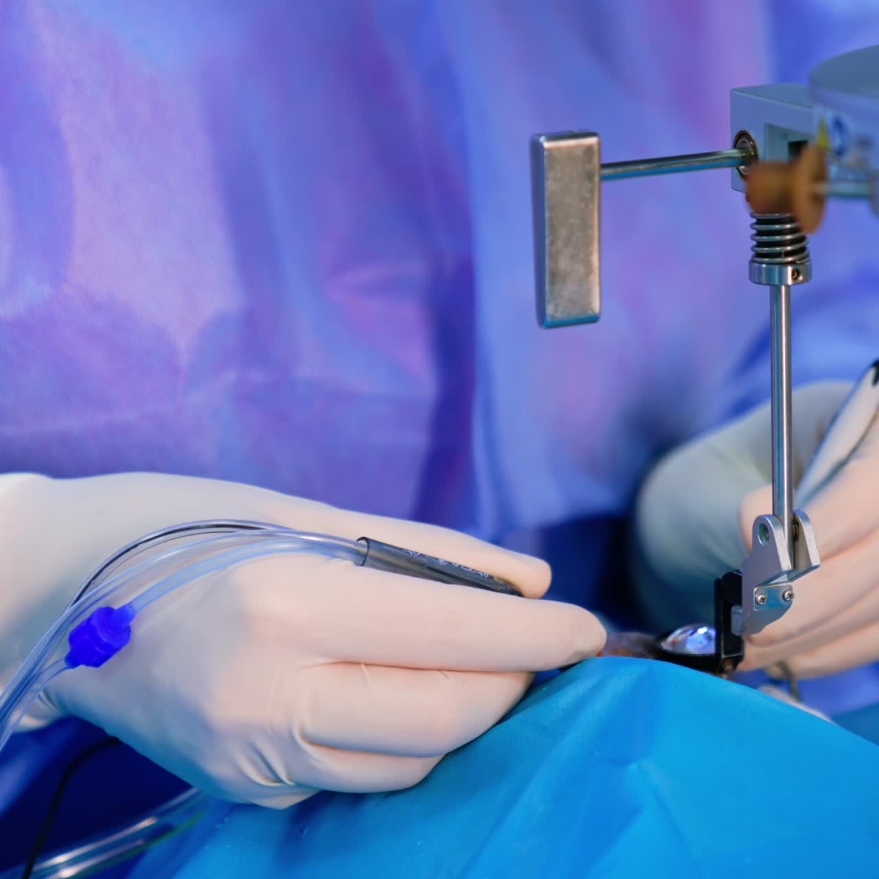 Ophthalmologist holds the tool devices in both hands. Doctor performs operation on the eye looking at lens. Close up