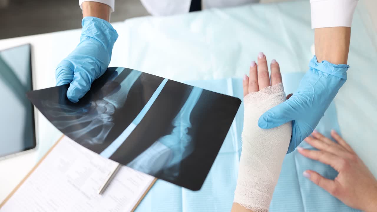 Médecin examinant la radiographie d'un poignet bandé