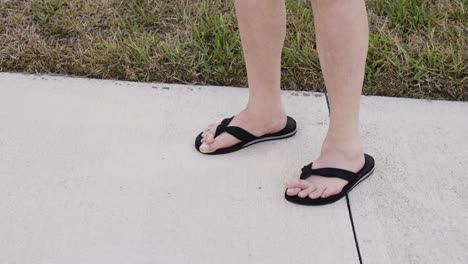 pies con punta de martillo, dedos de los pies cruzados entre sí, usando sandalias