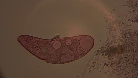 a microscopic view of the single-celled organism, blepharisma