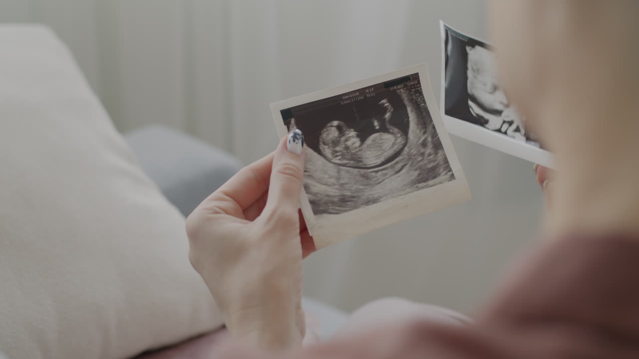 Woman looking at ultrasound images of baby