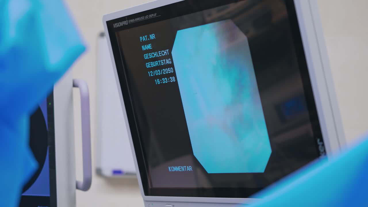 Endoscopic surgery on a display in hospital. Laparoscopic operation on the screen of a modern monitor in the operating room. Close-up.