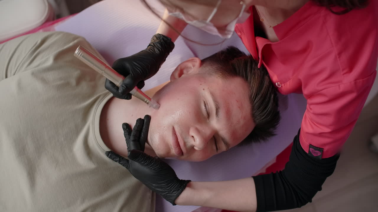 Man Receiving Derma Pen Facial Treatment