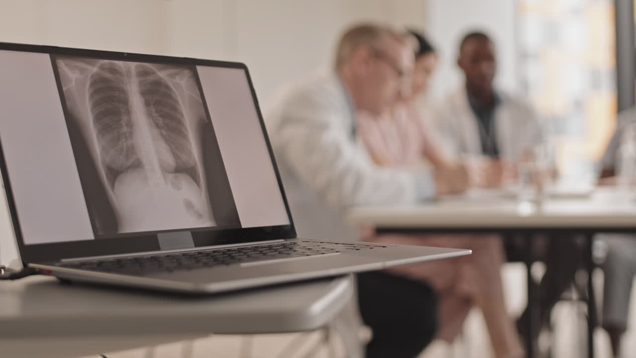 Medical team reviewing chest x-ray on laptop