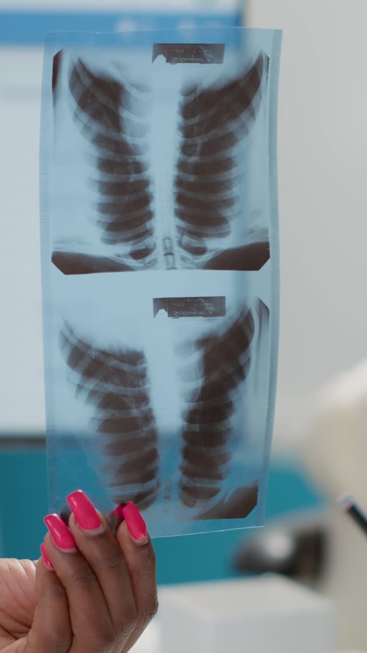 Examining an X-Ray