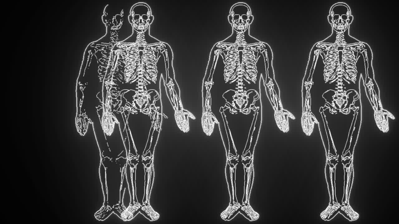 comparando los rayos x