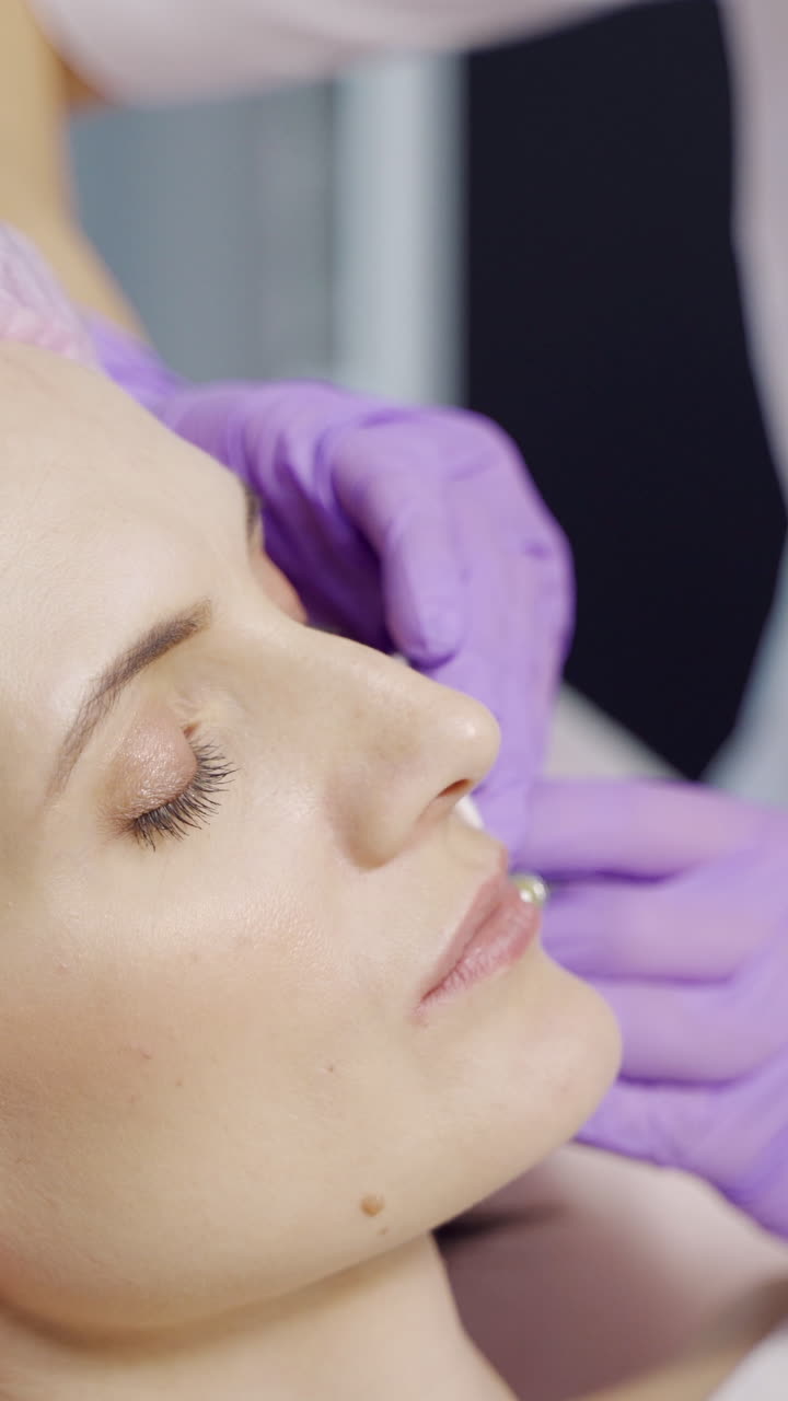 A specialist in aesthetic cosmetology holds a syringe in her hand and makes Botox injections to the lips for the client. Close-up. Vertical video