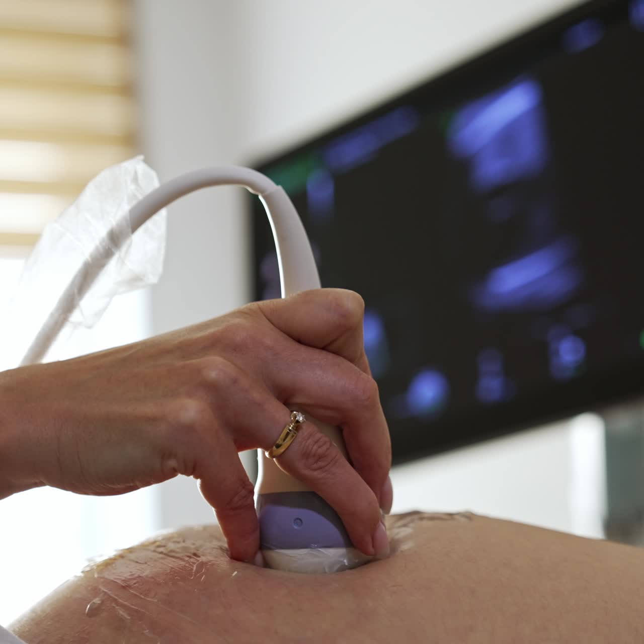 Ultrasonic diagnostic for pregnant lady. Doctor is moving the transducer by the patient's abdomen in the hospital. Close up. Black screen at backdrop in blur