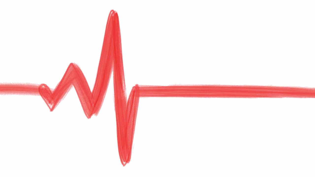 Hjerterytme EKG