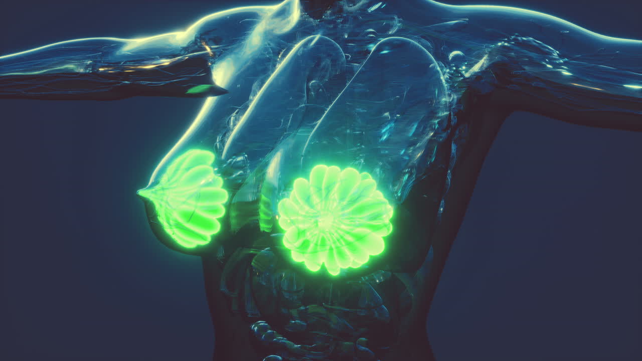 염증의 초점인 암을 가진 여성 유방