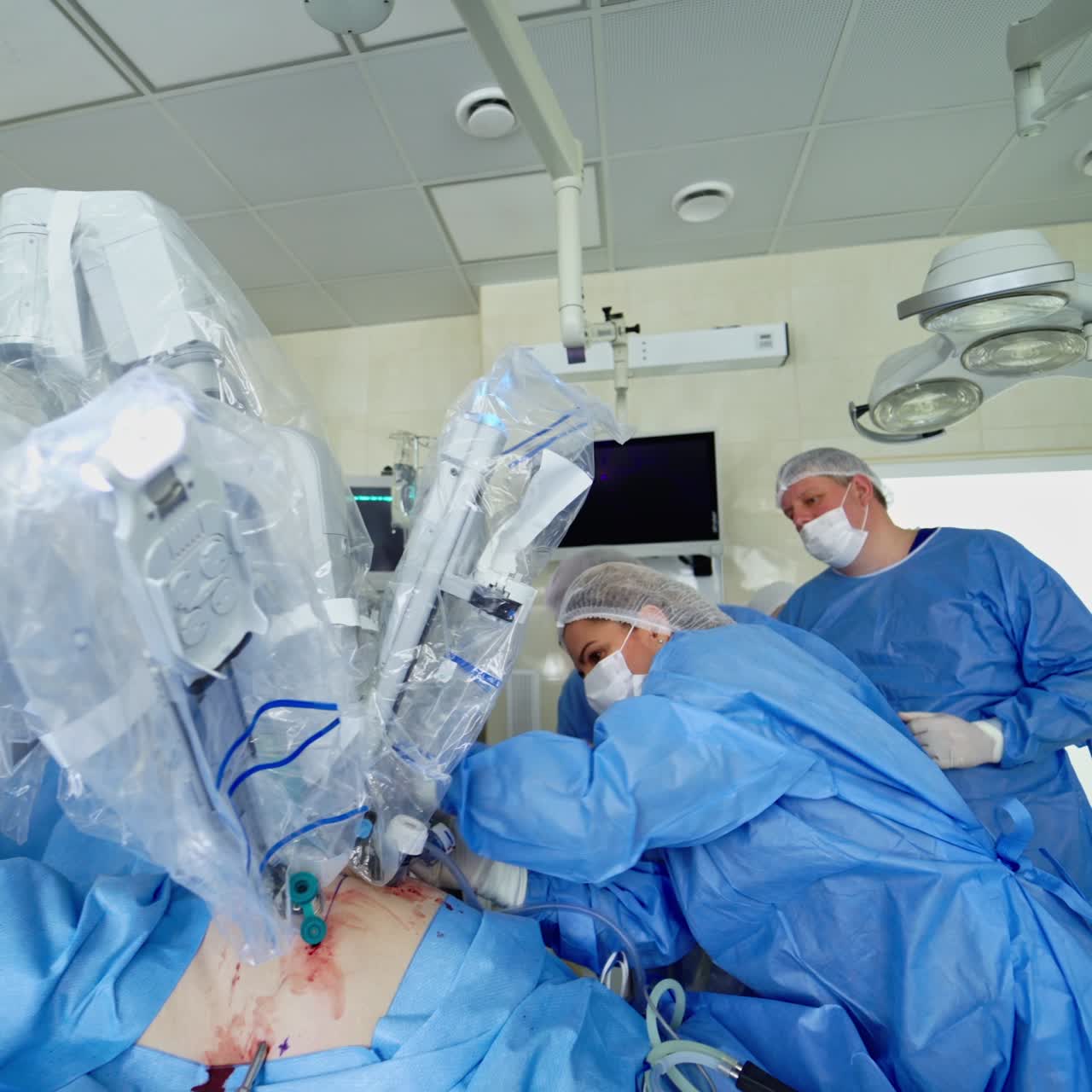 Medical operation involving robot. Group of doctors work near the medical robot in hospital. Robotic equipment in patient's body during operation. Modern medicine