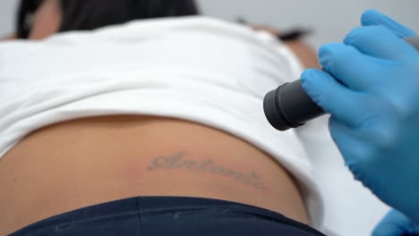 girl erasing tattoo of exboyfriend name, deleting or removing