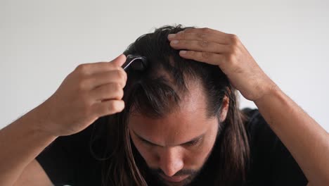 Hombre-Usando-Pelo-Rizado-En-Su-Cuero-Cabelludo-Para-Prevenir-La-Calvicie,-Caída-Del-Cabello