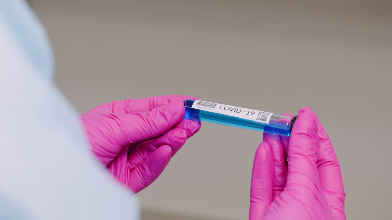 primer plano extremo del tubo de muestra covid 19 en las manos