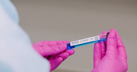 primer plano extremo del tubo de muestra covid 19 en las manos