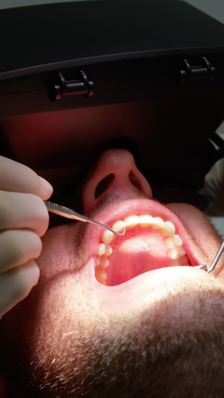 Dentist examining a male patient with dental tools