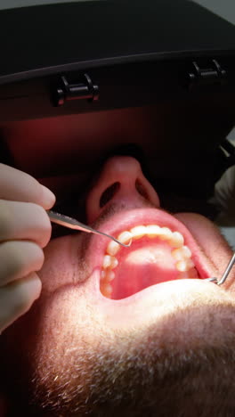 dentist examining a male patient with dental tools