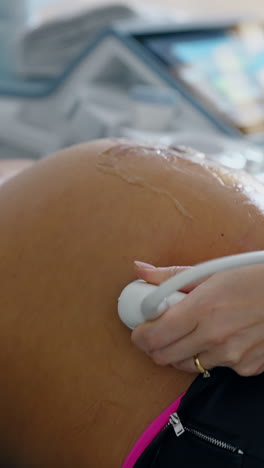 ultrasound check up for the pregnancy on last stages. doctor's hand moves the device by the gelled belly of expecting woman.. vertical video