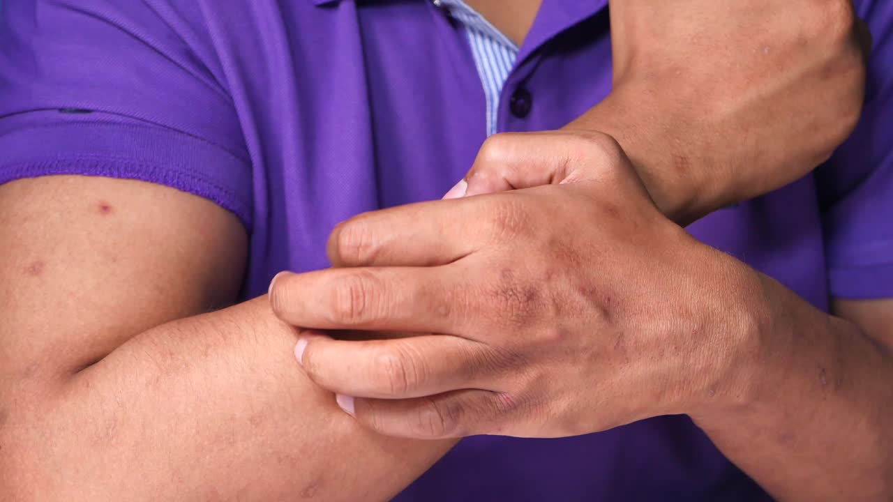 hombre rascándose el brazo