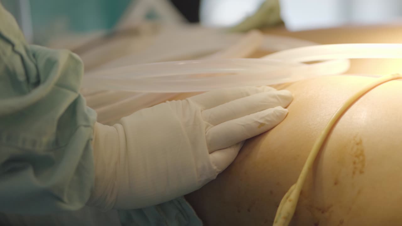 미학적 절차에 사용되는 의료 튜브