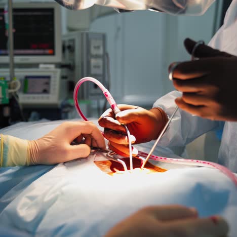 surgical tools in doctor's hands. surgeon uses medical tools and pipes during the operation on a patient in modern hospital. close-up.