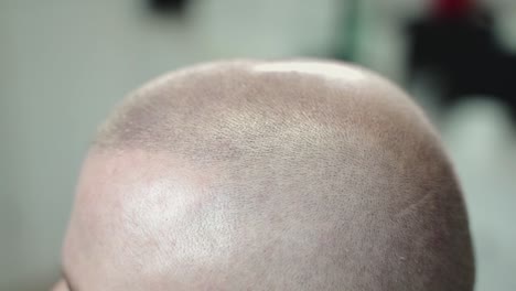 Man-in-micropigmentation-treatment