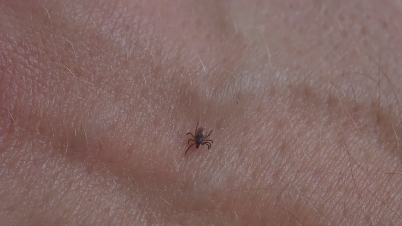Macro closeup of tick moving across skin representing parasite behavior and infection risk