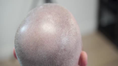hombre en tratamiento de micropigmentación