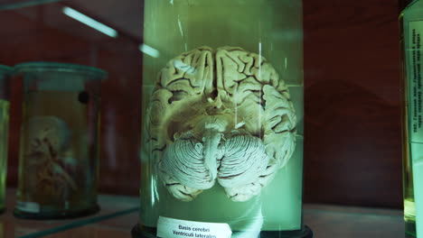 model of human brain in medical museum. internal organ preserved in formalin. anatomical model of cerebrum in laboratory. close-up.